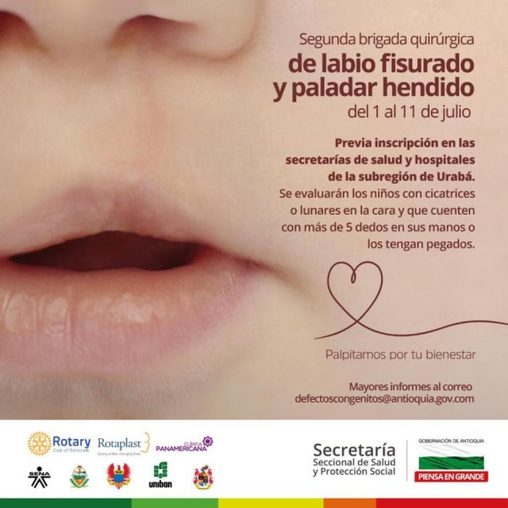 Cirugía plástica gratuita de labio fisurado y paladar hendido para niños y niñas de Urabá